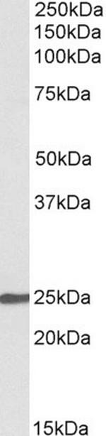 NBL1 Polyclonal Antibody