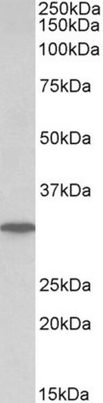 PNP Antibody in Western Blot (WB)