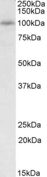 PEX6 Polyclonal Antibody