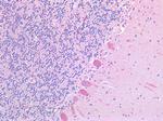 SLC6A8 Antibody in Immunohistochemistry (Paraffin) (IHC (P))