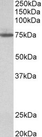 TGM4 Antibody in Western Blot (WB)