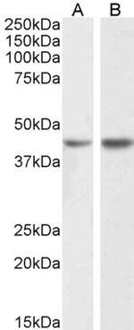Podocin Polyclonal Antibody