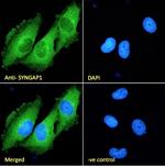 SynGAP Antibody in Immunocytochemistry (ICC/IF)