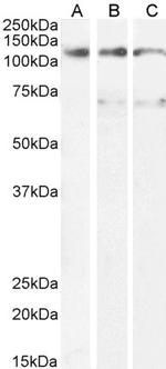 OSMR Polyclonal Antibody