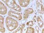 NOLC1 Antibody in Immunohistochemistry (Paraffin) (IHC (P))
