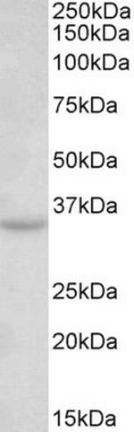 TSPAN5 Polyclonal Antibody