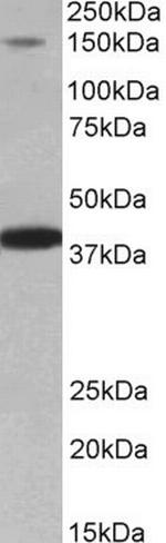 IRS4 Antibody in Western Blot (WB)