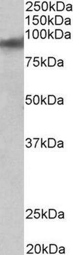 ZNF652 Antibody in Western Blot (WB)