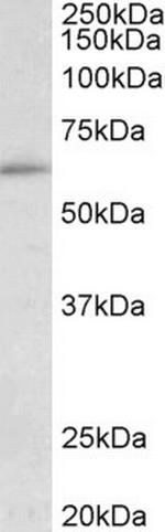 HIC2 Antibody in Western Blot (WB)