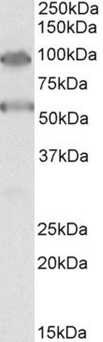 TBC1D9 Antibody in Western Blot (WB)