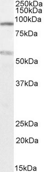 TBC1D9 Polyclonal Antibody
