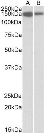 MCF2L Antibody in Western Blot (WB)
