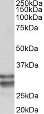 RFLAT-1 Polyclonal Antibody