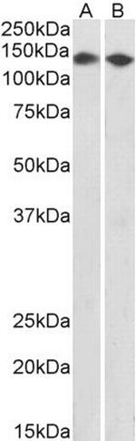 DBC1 Polyclonal Antibody