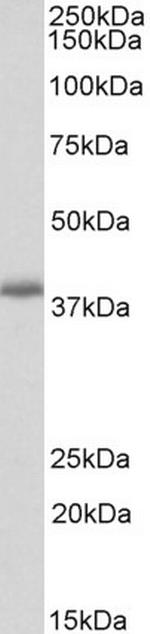 PDLIM2 Polyclonal Antibody