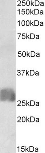 CREB3L2 Antibody in Western Blot (WB)