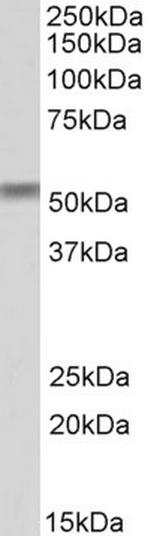 CREB3L2 Antibody in Western Blot (WB)