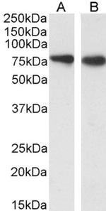 SLC26A6 Polyclonal Antibody