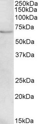 CROT Antibody in Western Blot (WB)