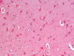 ZNRF1 Antibody in Immunohistochemistry (Paraffin) (IHC (P))