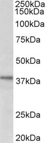 C12orf29 Antibody in Western Blot (WB)