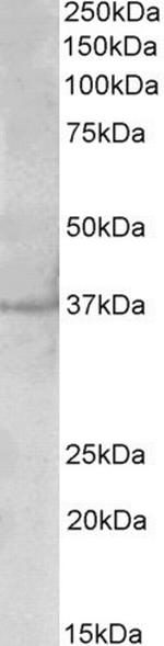 PLK5 Polyclonal Antibody
