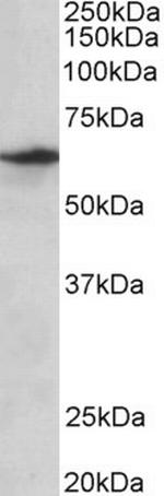 SLC47A2 Antibody in Western Blot (WB)
