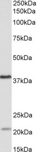 KLHDC8B Polyclonal Antibody