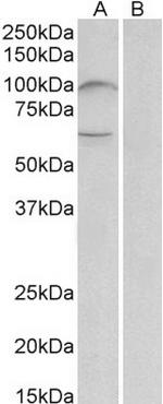 UNC5B Polyclonal Antibody