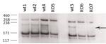 ZCCHC11 Polyclonal Antibody