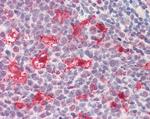DNAJC5G Antibody in Immunohistochemistry (Paraffin) (IHC (P))