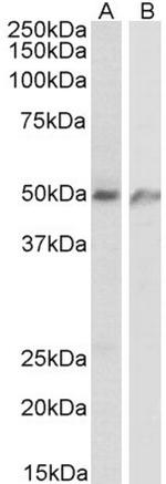ECSCR Antibody in Western Blot (WB)