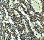 QSOX1 Polyclonal Antibody