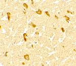 DPF3 Polyclonal Antibody