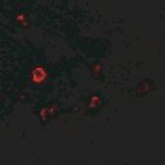 IL1RL2 Antibody in Immunohistochemistry (Paraffin) (IHC (P))