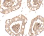 IL1RL2 Polyclonal Antibody