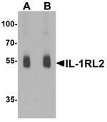 IL1RL2 Antibody in Western Blot (WB)