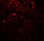 TRIP12 Antibody in Immunohistochemistry (Paraffin) (IHC (P))