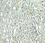 Rubicon Polyclonal Antibody