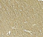 TENM1 Polyclonal Antibody