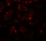PPARGC1A Antibody in Immunohistochemistry (IHC)