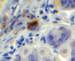 PPARGC1A Antibody in Immunohistochemistry (IHC)