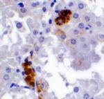 PPARGC1A Antibody in Immunohistochemistry (IHC)