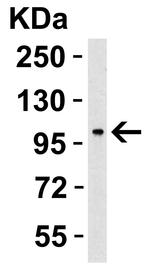 PPARGC1A Antibody in Western Blot (WB)
