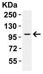 PPARGC1A Antibody in Western Blot (WB)