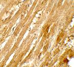WAPL Polyclonal Antibody