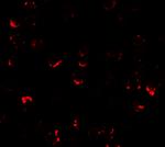 ATMIN Polyclonal Antibody