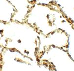 BAMBI Polyclonal Antibody