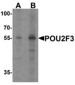 PLA1 Antibody in Western Blot (WB)