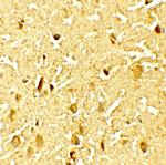 Phospho-SAMHD1 (Thr592) Antibody in Immunohistochemistry (Paraffin) (IHC (P))
